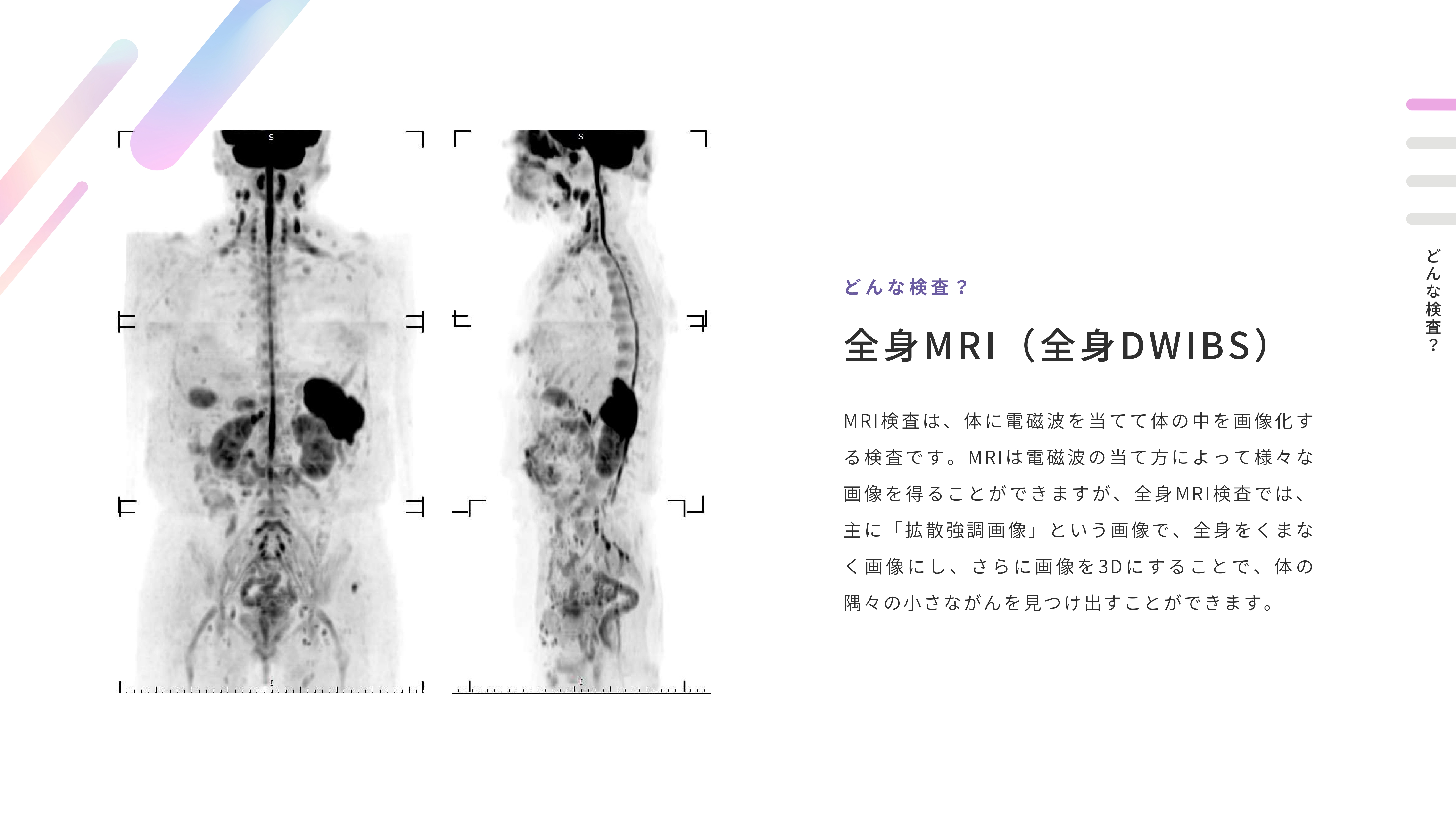 全身　全身MRIとは